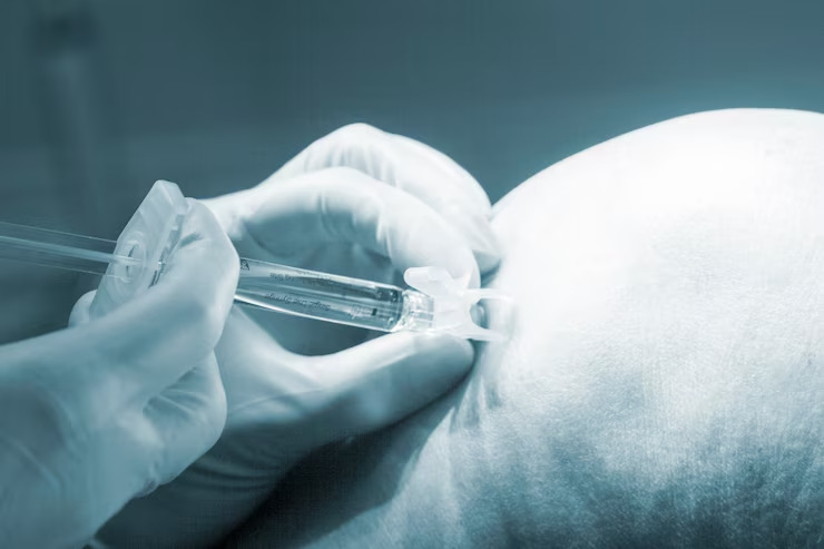 Does-IVF-Increase-the-Chance-of-Twin-Pregnancy