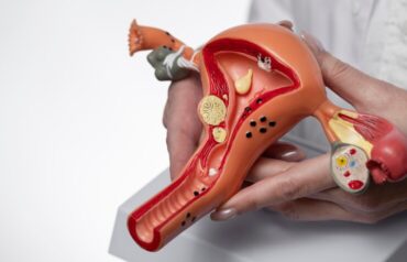 Endometriosis-Treatment (1)